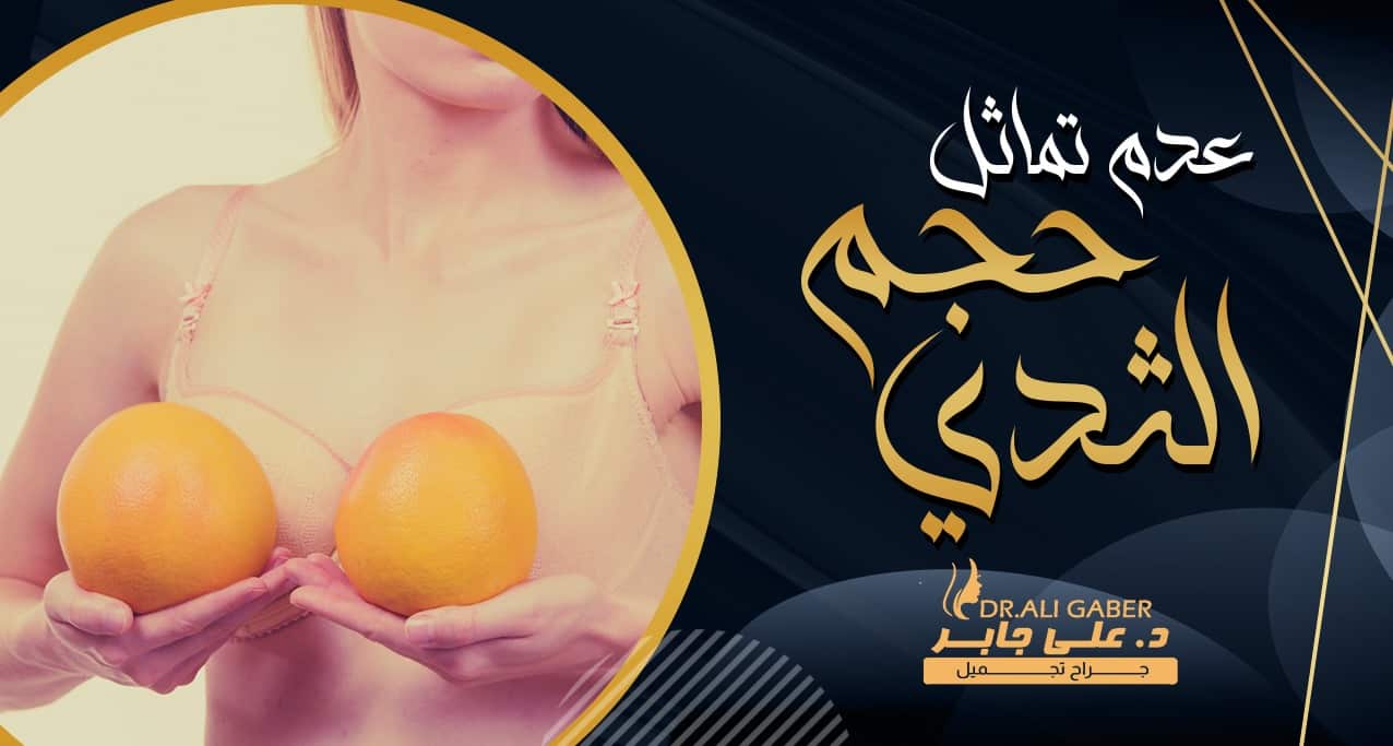 مشكلة عدم تساوي حجم الثديين