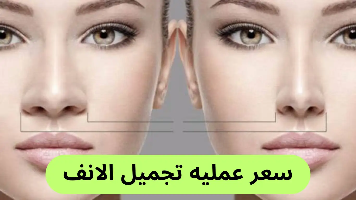 سعر عمليه تجميل الانف