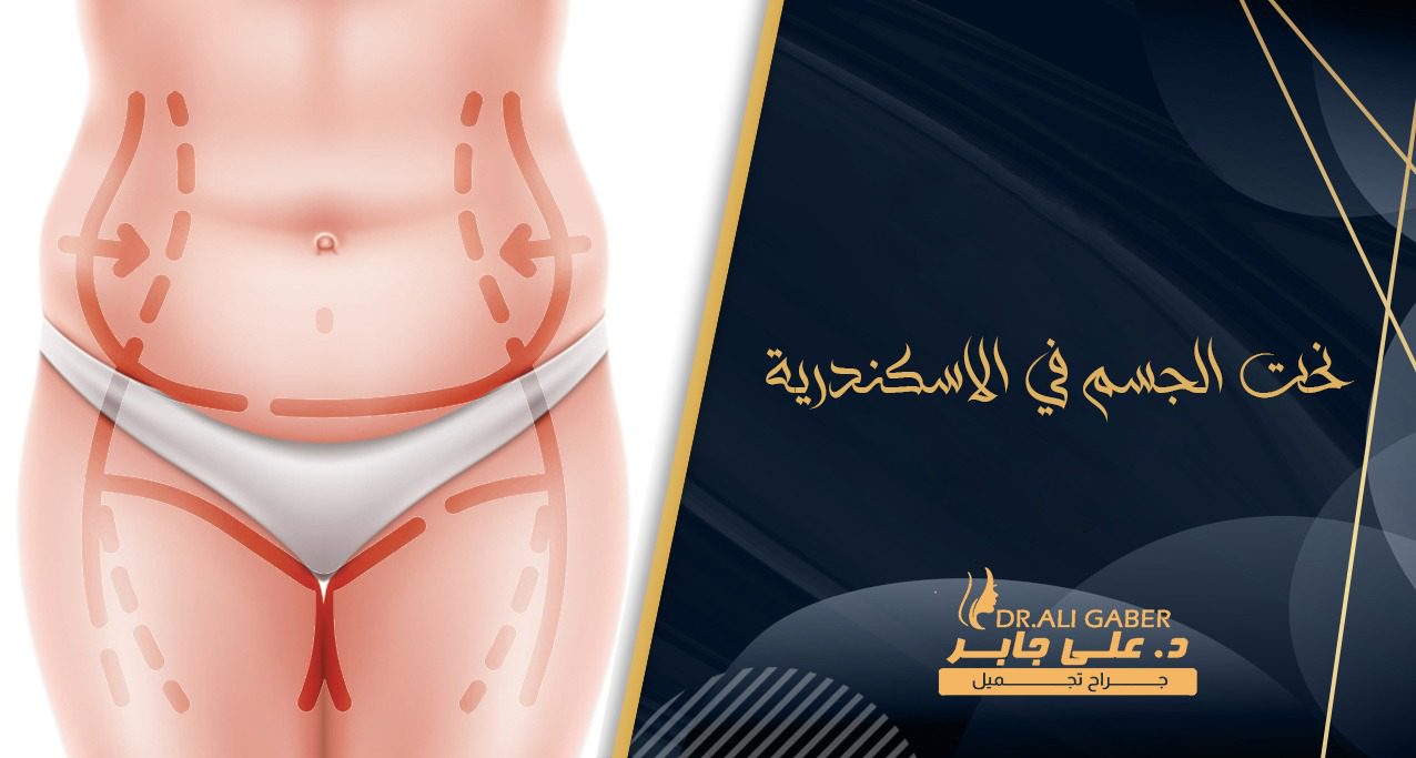 نحت الجسم في الاسكندرية