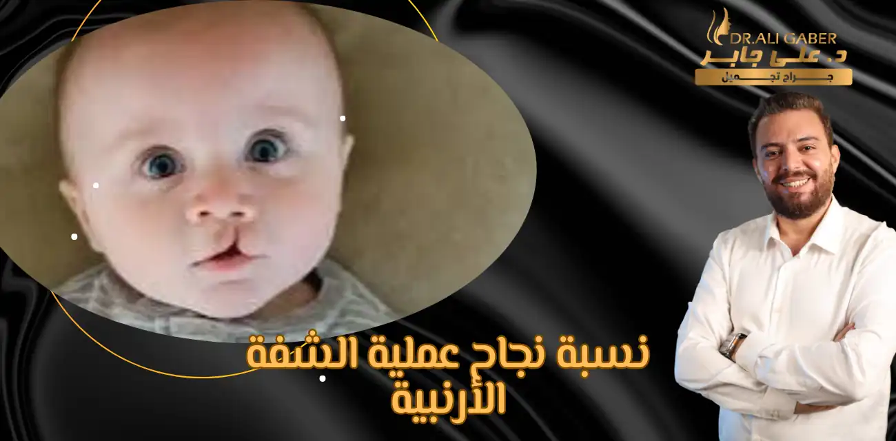 اسباب الشفة الارنبية