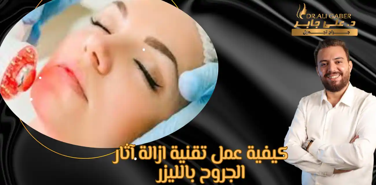 سعر عملية تجميل الجروح