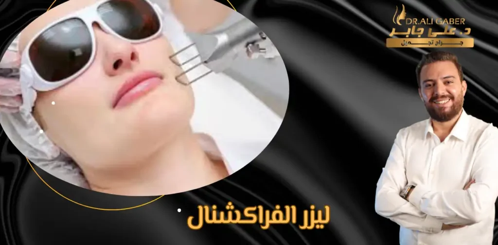 تجربتي مع ليزر الفراكشنال
