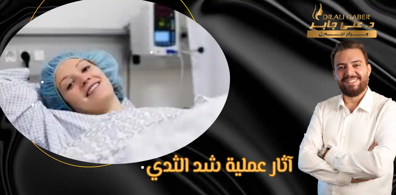 شد الثدي بالليزر