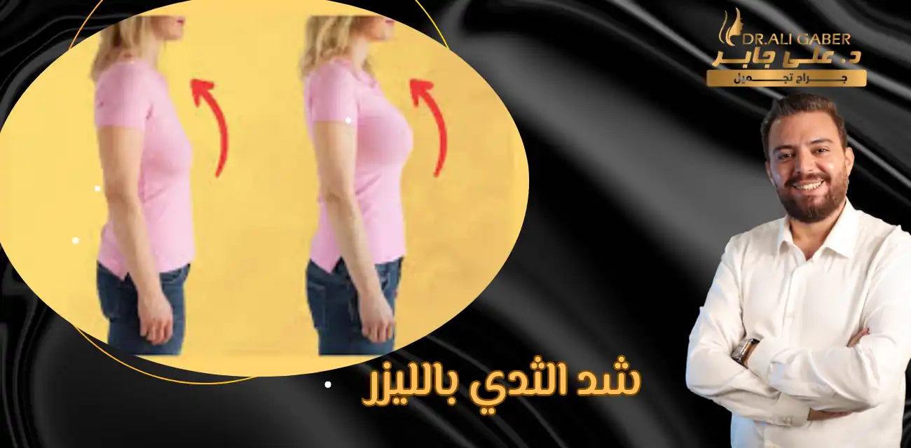 شد الثدي بالليزر