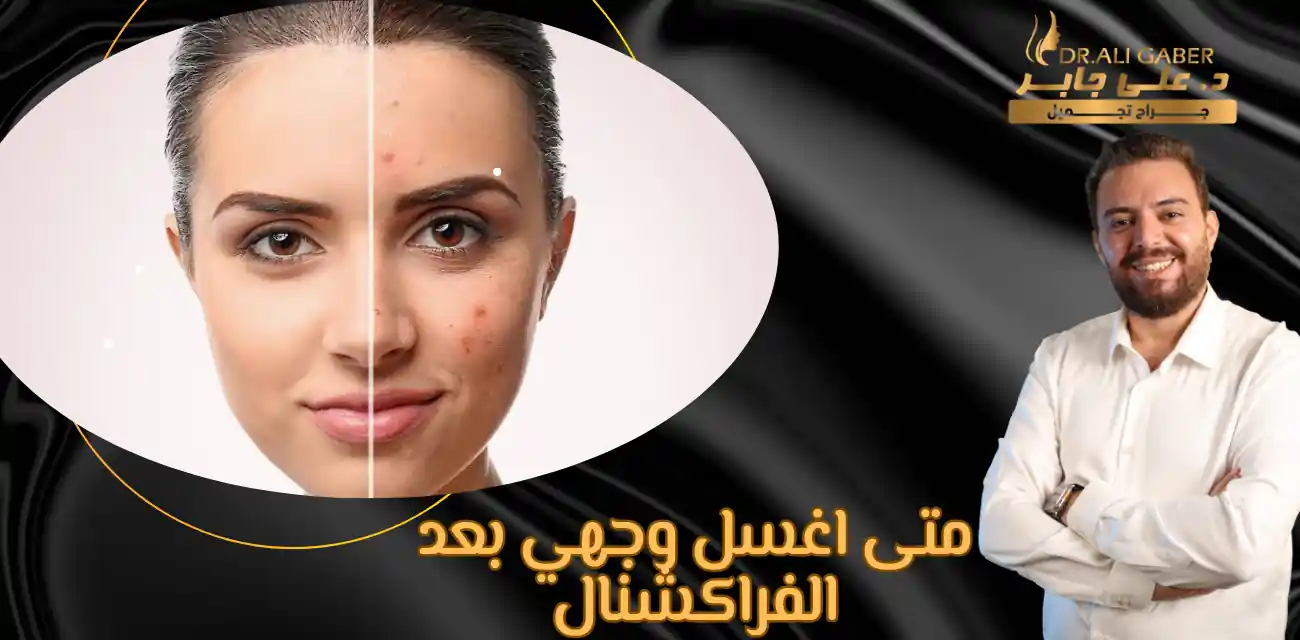 متى اغسل وجهي بعد الفراكشنال