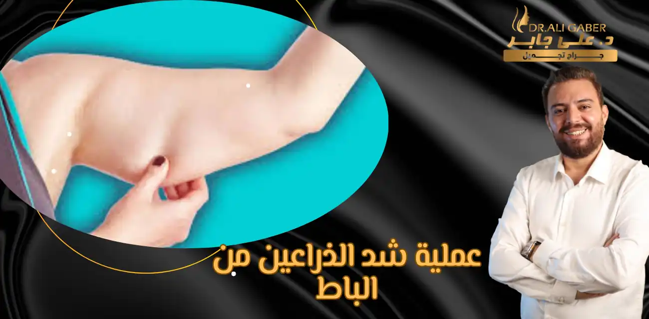 عملية شد الذراعين من الباط