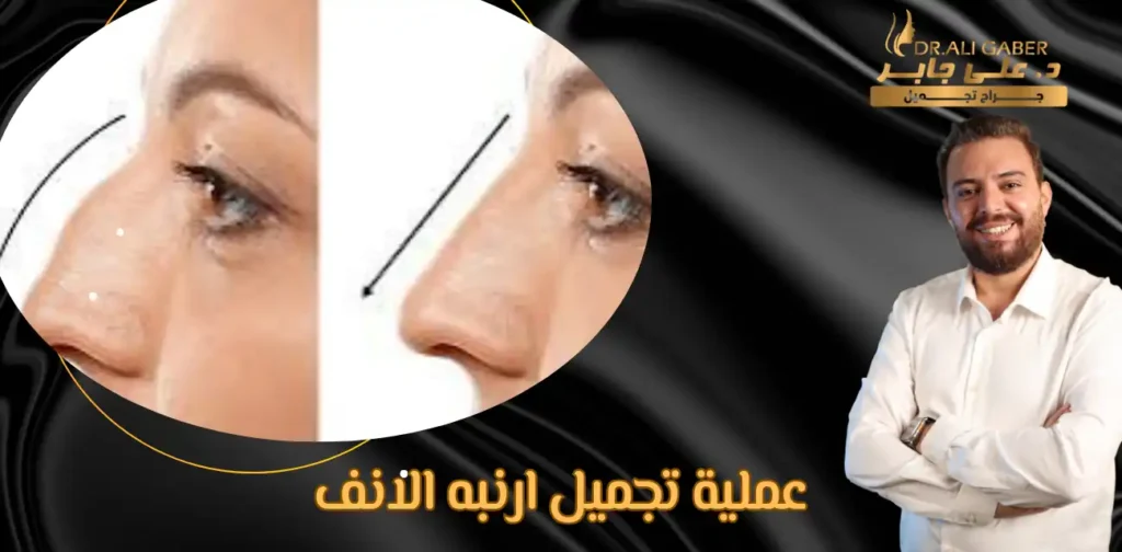 عملية تجميل ارنبه الانف