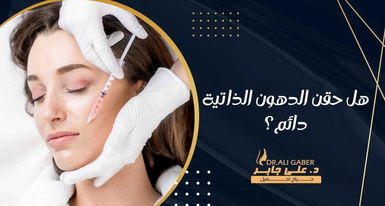 هل حقن الدهون الذاتية دائم؟